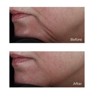 Perricone, MD, high potency face firming serum